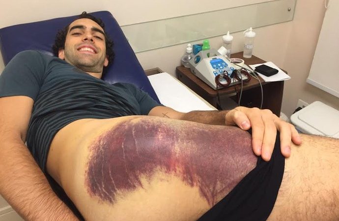 Após ouro na final, Benite revela super-hematoma: “Ainda está doendo”