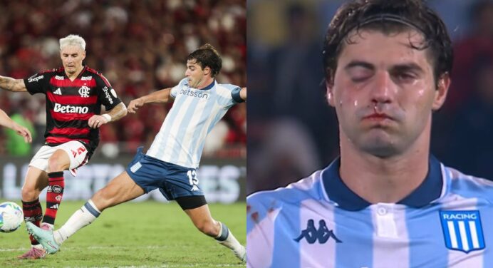 Jogador do Racing passará por cirurgia após quebrar o maxilar no jogo contra o Flamengo